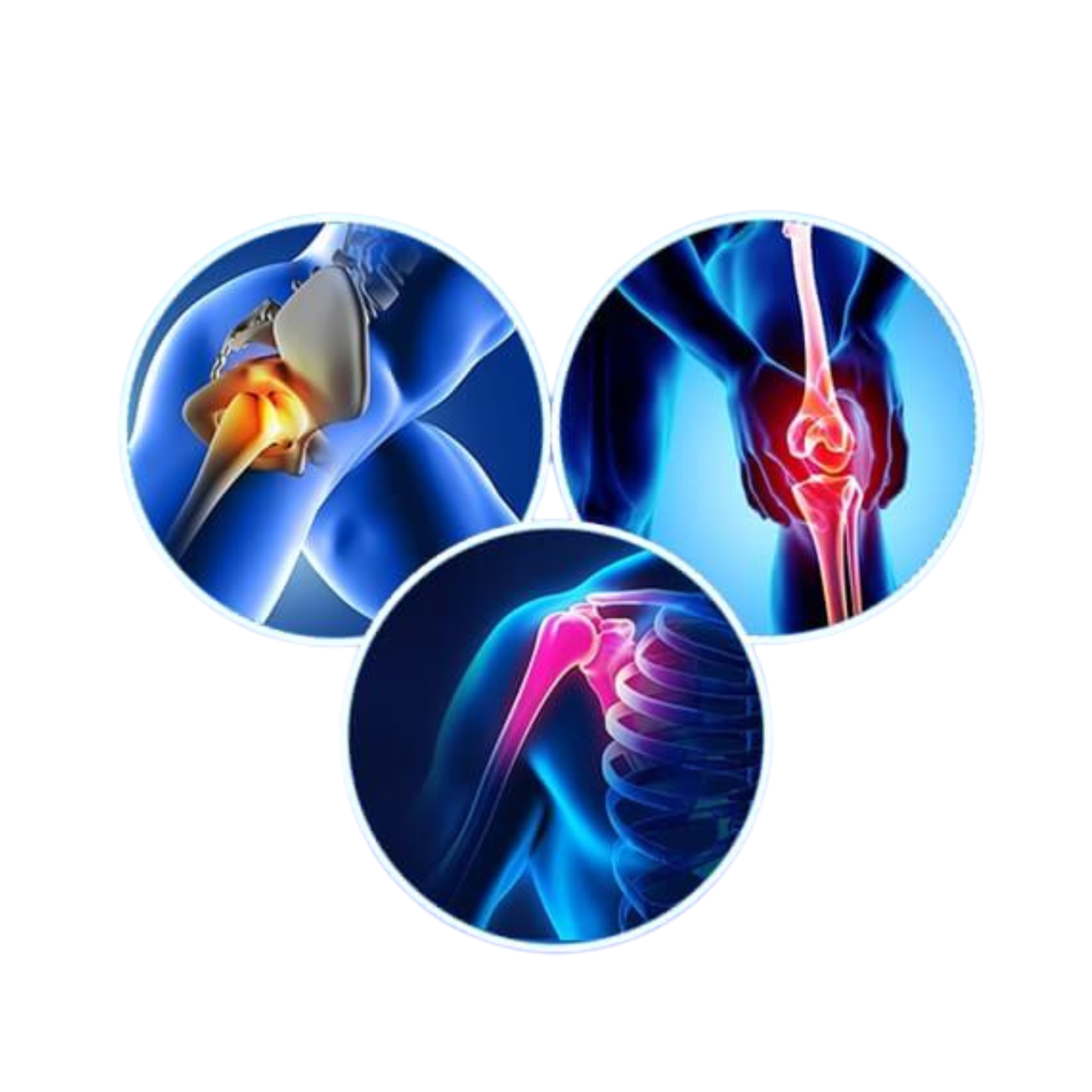 Angiography & Angioplasty